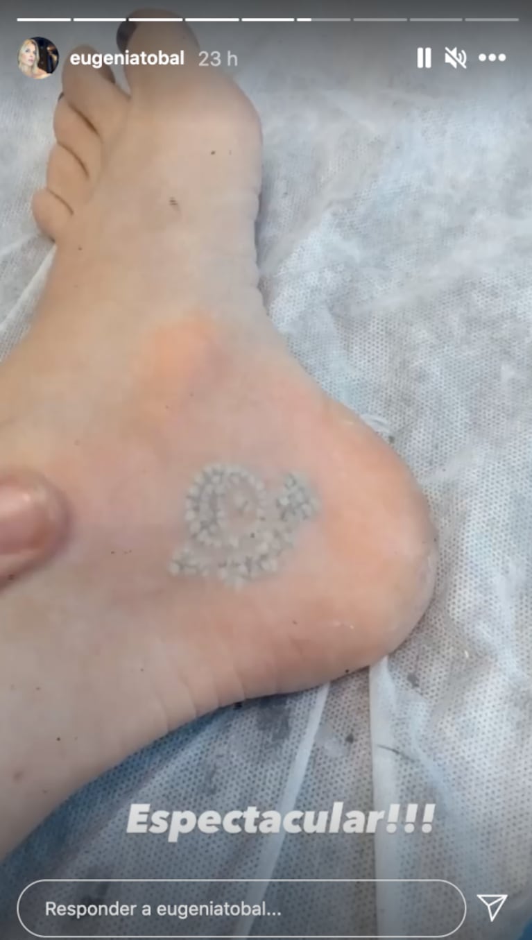 Eugenia Tobal reveló por qué decidió removerse uno de sus tatuajes: "No representa lo que yo quería"