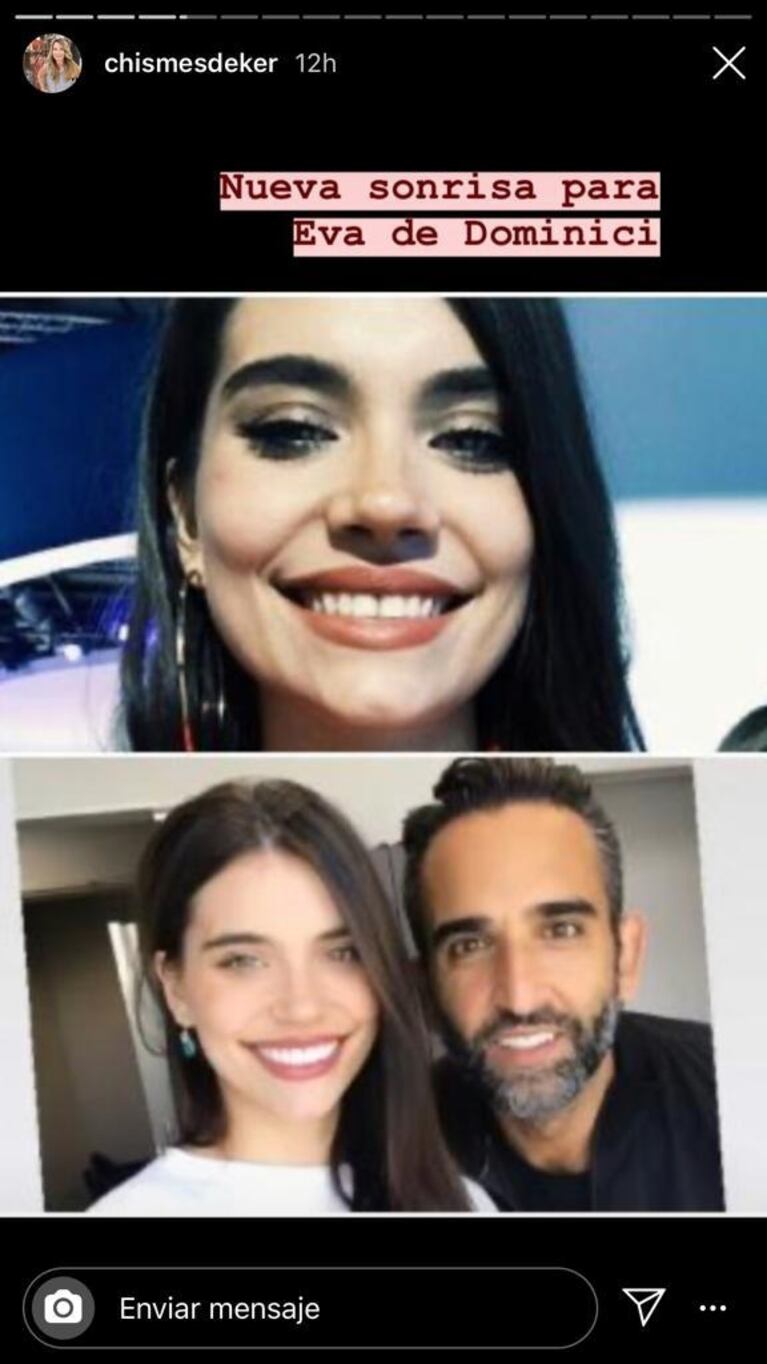 Eva de Dominici lució su "nueva sonrisa": dentadura perfecta y muchísimo más blanca
