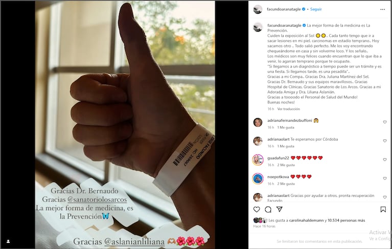 Facundo Arana reveló la enfermedad que padece: “Cada tanto tengo que sacarme lesiones”