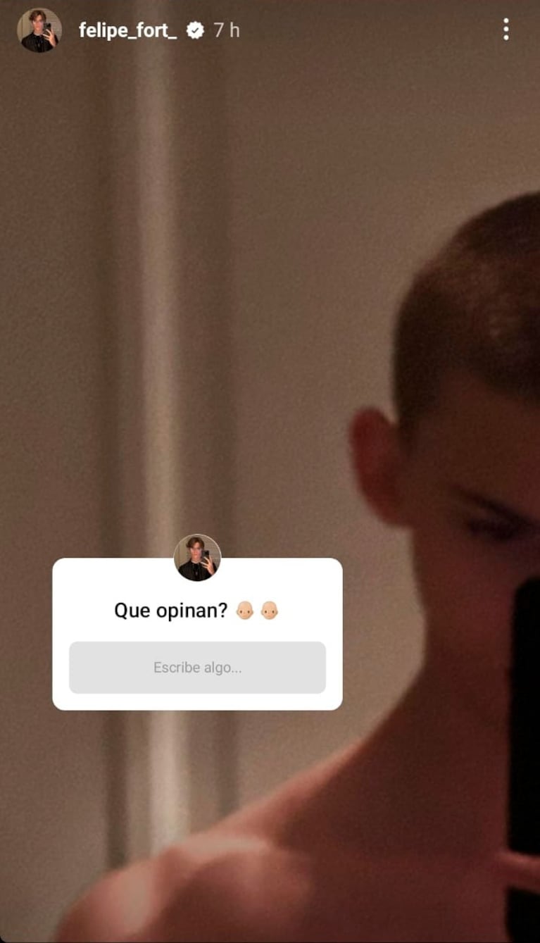 Felipe Fort sorprendió con su radical cambio de look: “¿Qué opinan?”