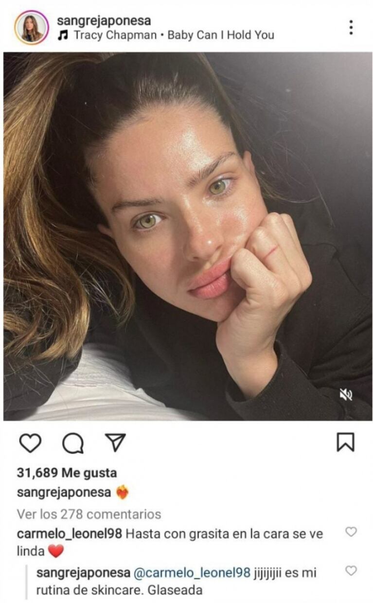 Firme reacción de China Suárez cuando le dijeron que tiene la piel grasosa