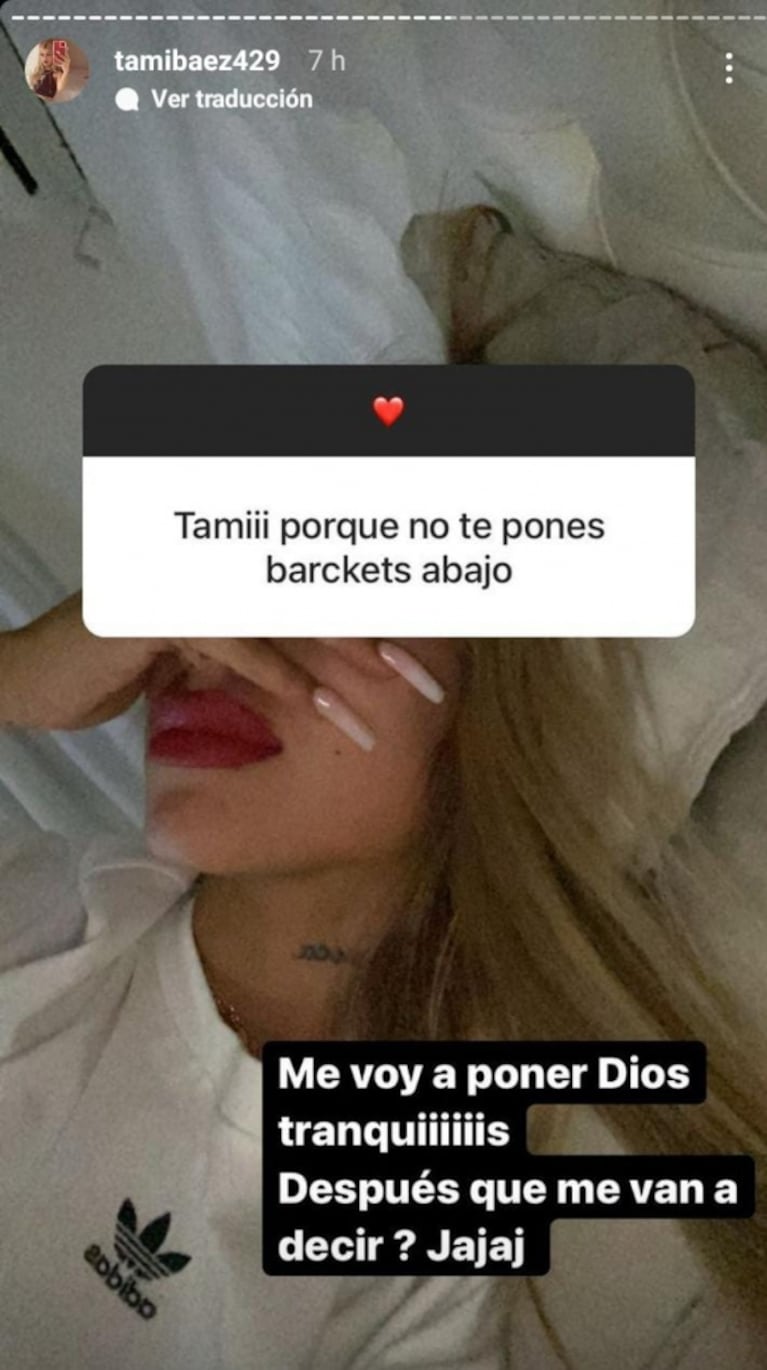 Firme reacción de Tamara Báez cuando le dijeron que se arregle la dentadura