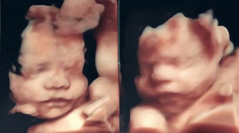 Flavio Mendoza presentó a Giselle, la madre subrogada de Dionisio, su hijo: "Busqué una mujer muy parecida a mis hermanas"