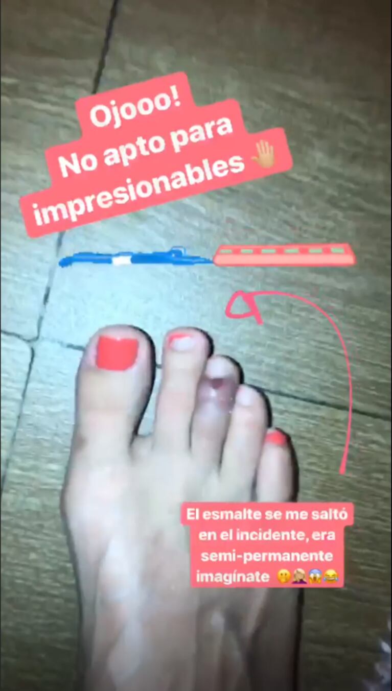 Florencia Bertotti mostró fotos de su accidente en sus vacaciones en Cancún: "No apto para impresionables"