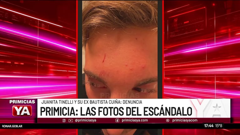 Foto: Captura (América)