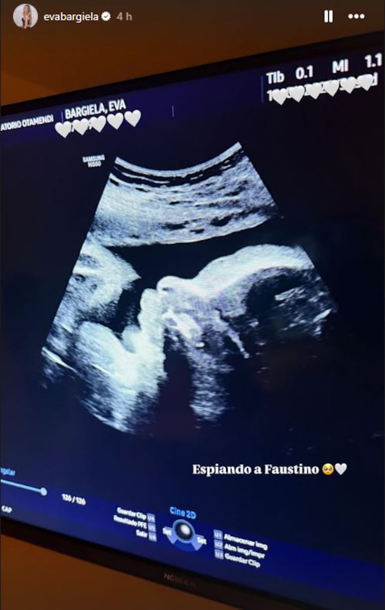 Foto: Captura de Instagram Stories (@evabargiela)