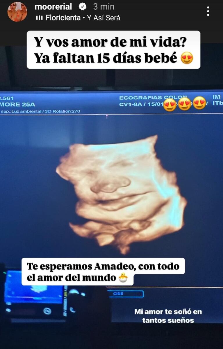 Foto: Captura de Instagram Stories (@moorerial)