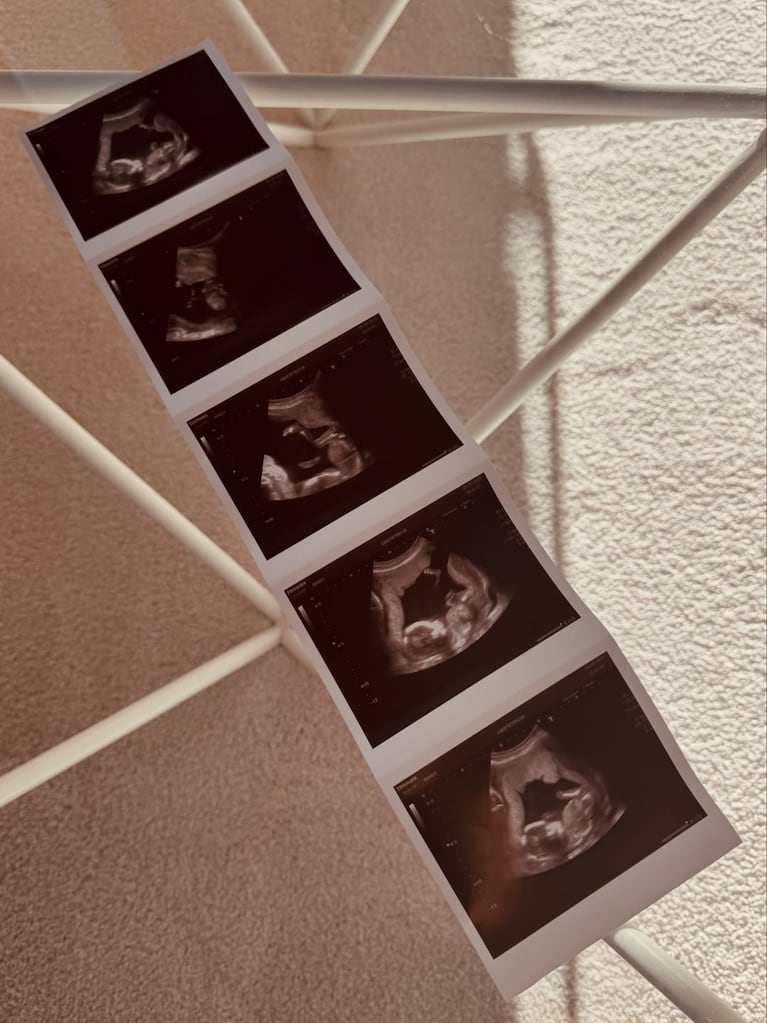 Foto: Instagram (@evabargiela)