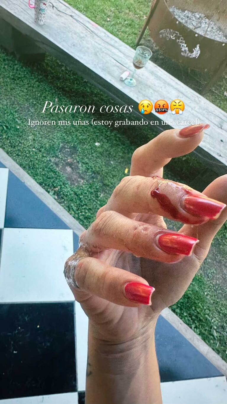 Foto: Instagram @sangrejaponesa