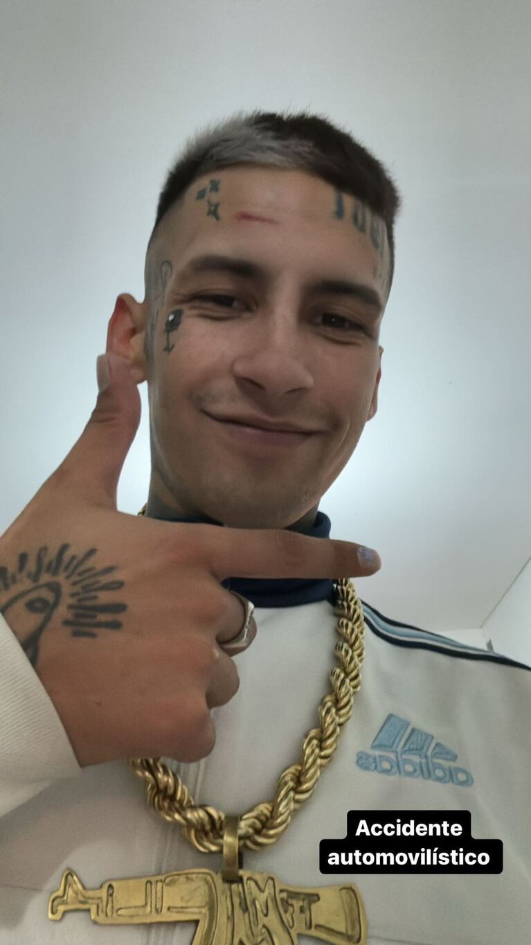 Foto: Instagram Stories