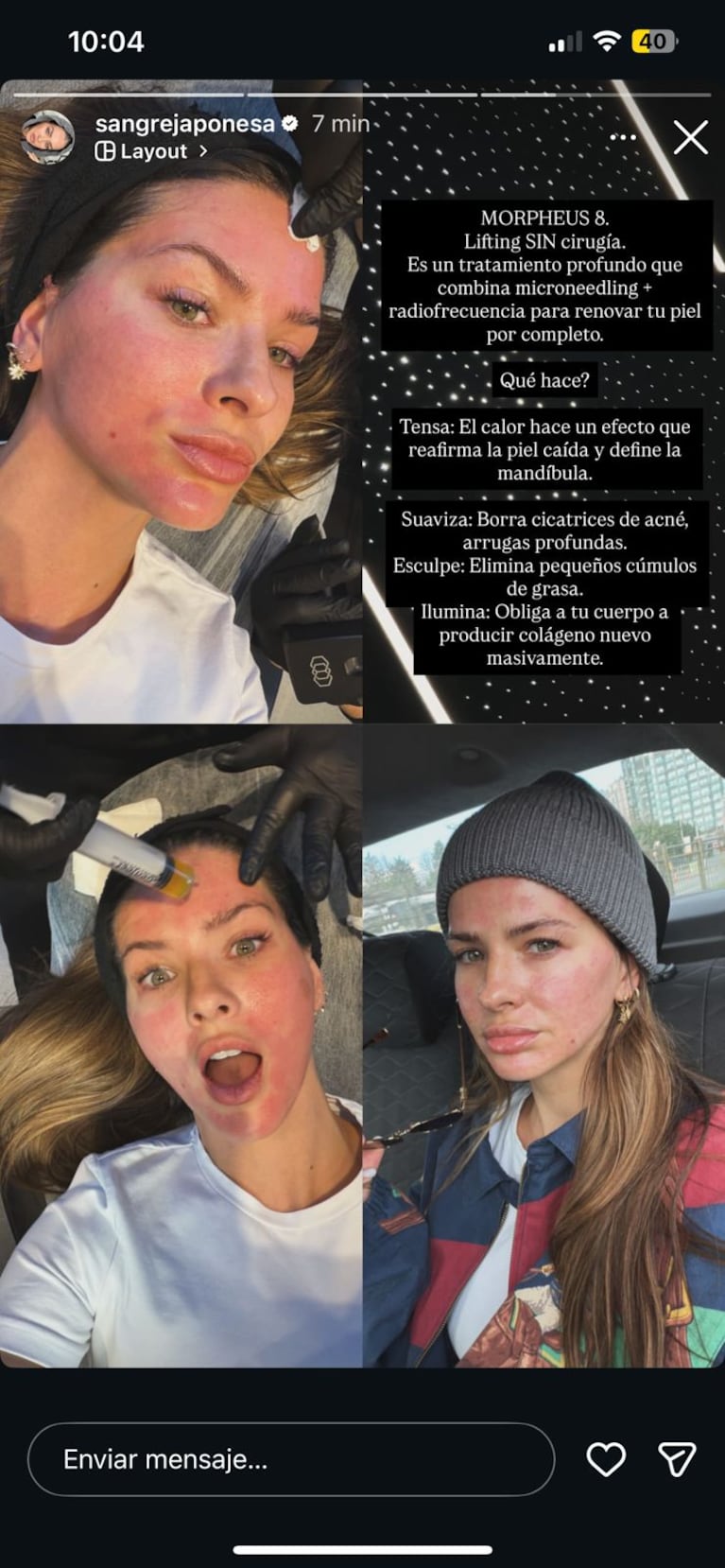 Foto: @sangrejaponesa