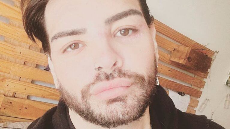 Fran Mariano zafó de la amputación y reclamó: Quiero mi lugar en los medios