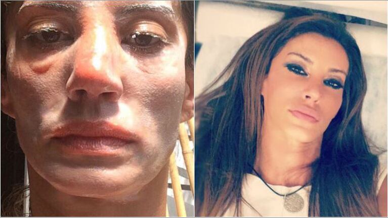 Fuerte denuncia de Natacha Jaitt: Mi denuncia ex me dio una trompada y huyó