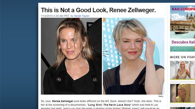 Furor por el "cambio de cara" de Renee Zellweger. (Captura TMZ.com)
