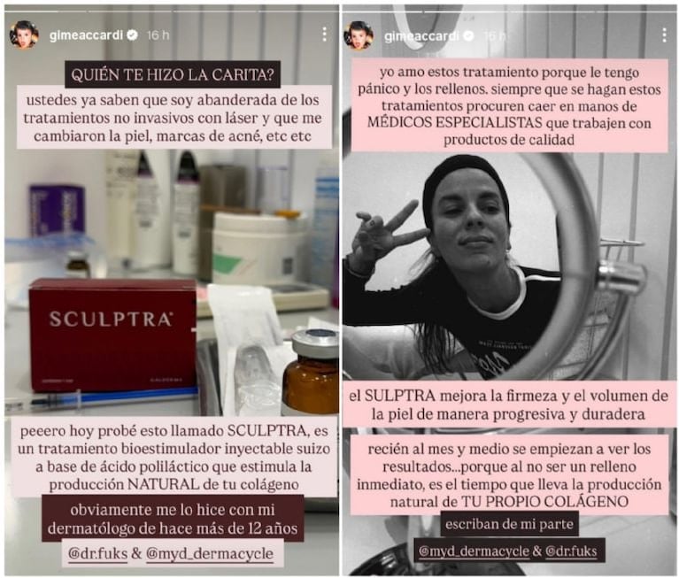 Gimena Accardi reveló su tratamiento estético y sorprendió con los resultados. Crédito: Instagram