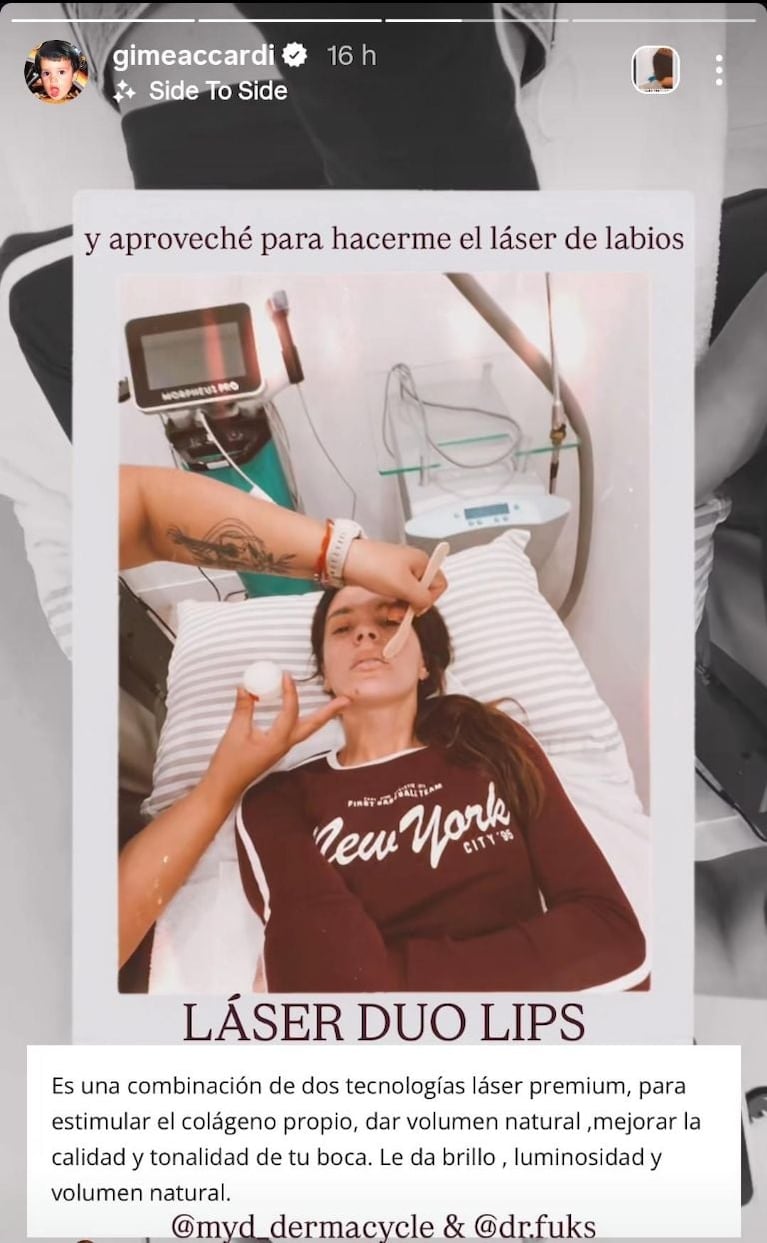 Gimena Accardi reveló su tratamiento estético y sorprendió con los resultados. Crédito: Instagram