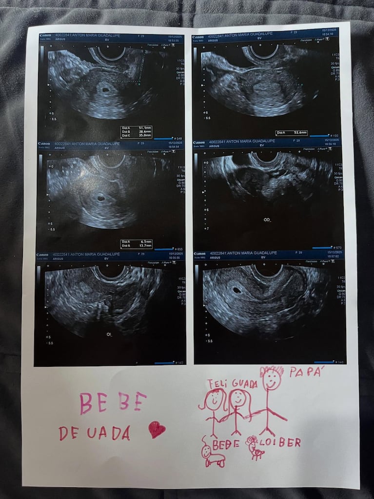 Guadalupe Antón, exestrella de Casi Ángeles, espera su primer hijo. Crédito: Instagram