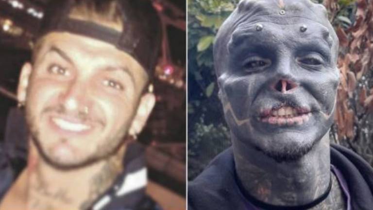 Hombre se quita nariz, labio y orejas para parecerse a un alienígena negro