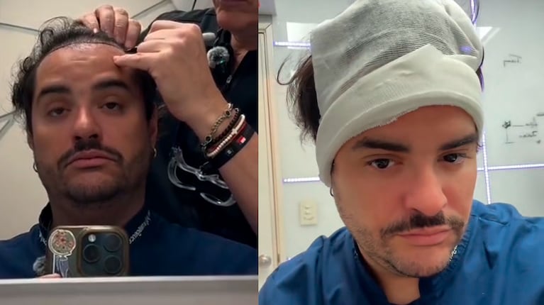 Homero Petinatto se hizo un tratamiento capilar y lanzó una divertida chicana a los pelados (Captura de Instagram)
