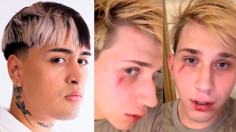 El streamer Brunenger denunció que Tiago PZK lo molió a golpes y el cantante se defendió: los videos