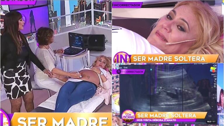 La ecografía que Débora D'Amato se realizó en el vivo de Incorrectas