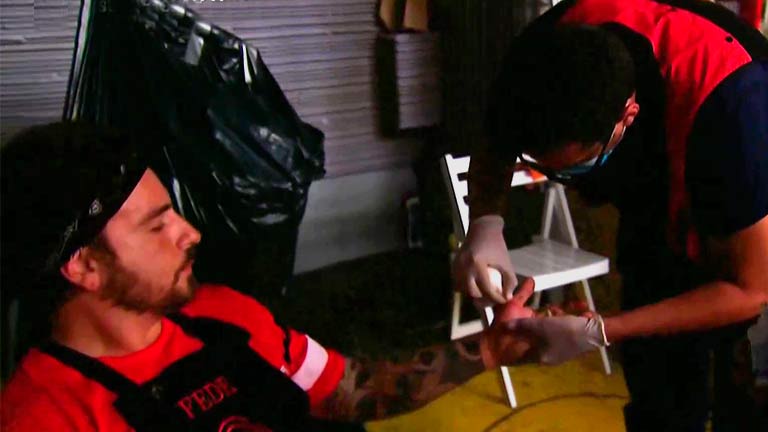Fede Bal sufrió un severo corte en su mano en MasterChef Celebrity