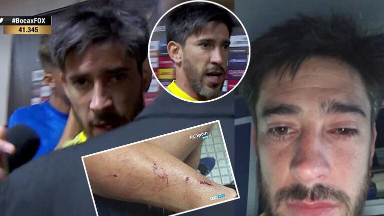 Así quedó Pablo Pérez, el capitán de Boca, luego del ataque al micro que trasladaba a los jugadores al Monumental
