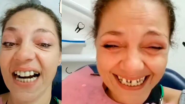 Tamara Paganini mostró un video con el nuevo tratamiento de su dentadura