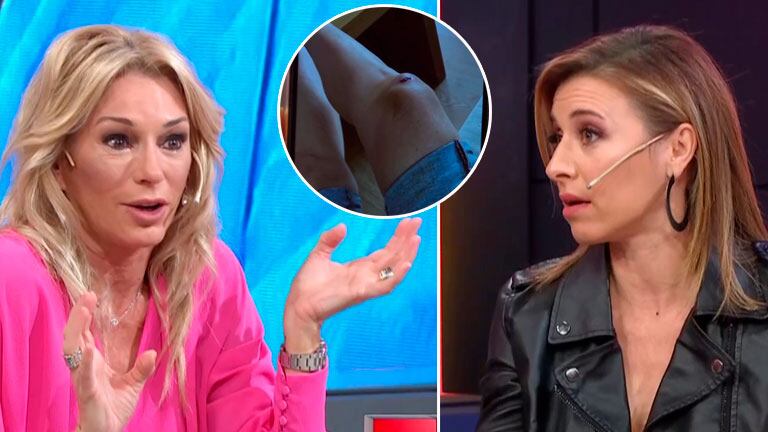 Yanina Latorre relató su tremenda caída en la calle y Mariana Brey explicó el significado emocional