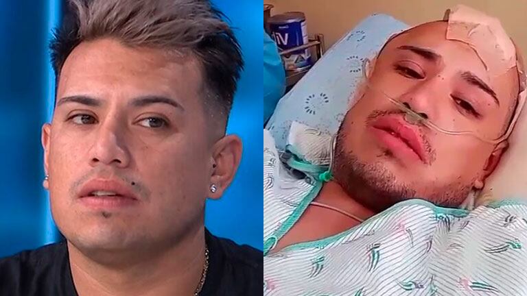 Gonzalo Muñoz, líder de los Wachiturros, habló tras caerse del escenario y golpearse la cabeza después de dar un show