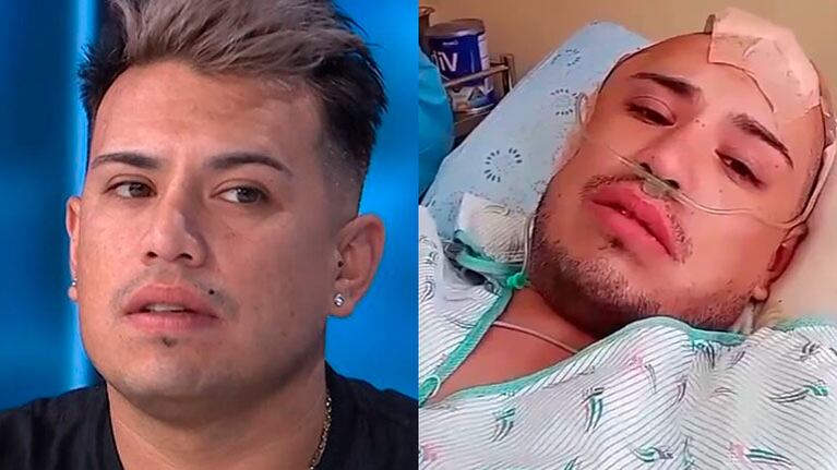 Gonzalo Muñoz, líder de los Wachiturros, habló tras caerse del escenario y golpearse la cabeza después de dar un show