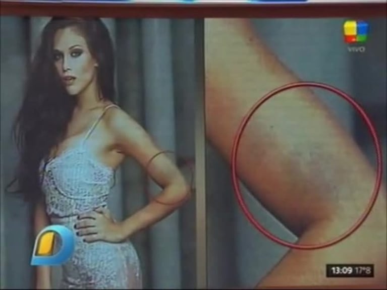El llamativo moretón de Barbie Vélez en las fotos de Gente