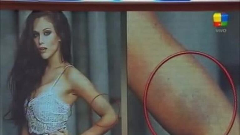 El llamativo moretón de Barbie Vélez en las fotos de Gente