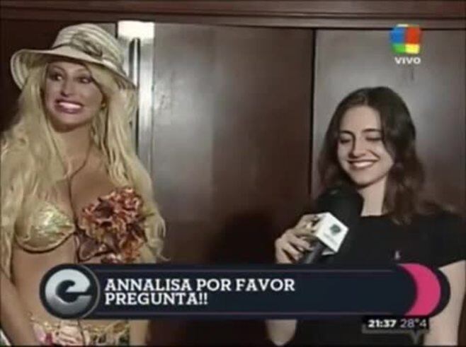 Vicky Xipolitakis y la polémica foto de sus cicatrices