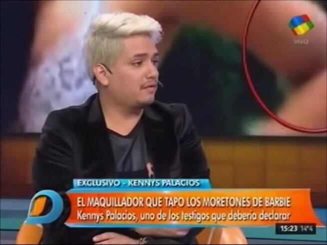Kennys Palacios mostró un video de los moretones de Barbie que presentarán en la causa