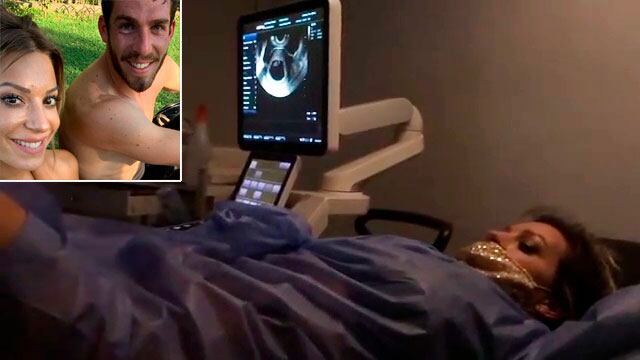 Las emocionantes imágenes de la primera ecografía y el latido del corazón del bebé de Noelia Marzol