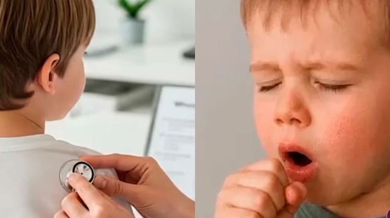 Suben los casos de coqueluche en la Argentina: qué es y por qué pone en riesgo a los niños