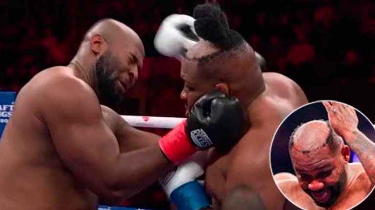 El blooper de Jarrell “Big Baby” Miller: perdió el peluquín en plena pelea y se volvió viral