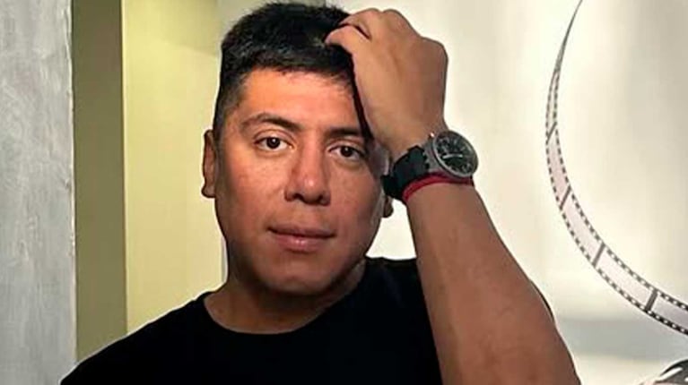 Impactante: un perro mordió a Mariano de la Canal y le desfiguró la cara