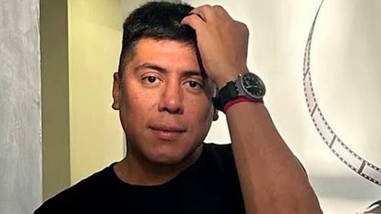 Impactante: un perro mordió a Mariano de la Canal y le desfiguró la cara