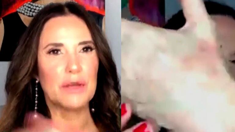 María Fernanda Callejón sufrió efectos postraumáticos después de su internación