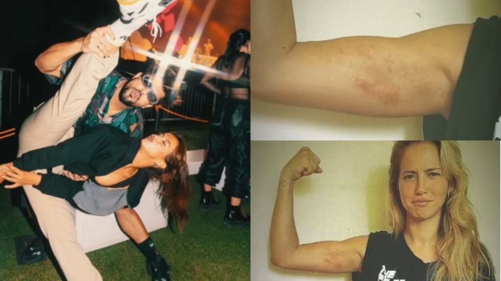 Flor Vigna mostró su brazo lastimado a días debutar en La Academia: "Hola doble ensayo, hola moretones"