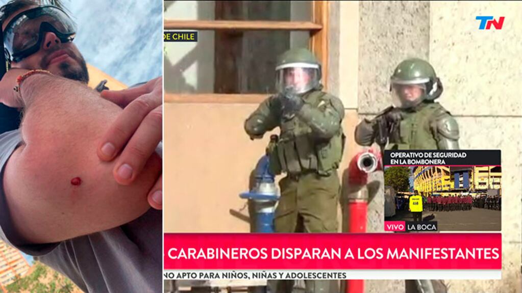 El video del momento exacto en que el equipo de TN fue baleado en vivo por los Carabineros chilenos