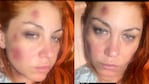 Lowrdez de Bandana acusó a su pareja por violencia de género y mostró las heridas