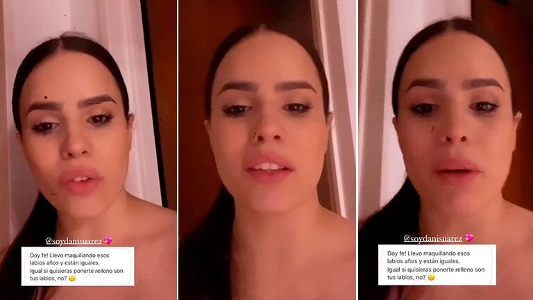La respuesta sin filtro de Sofi Morandi a los que dicen que se puso relleno en los labios