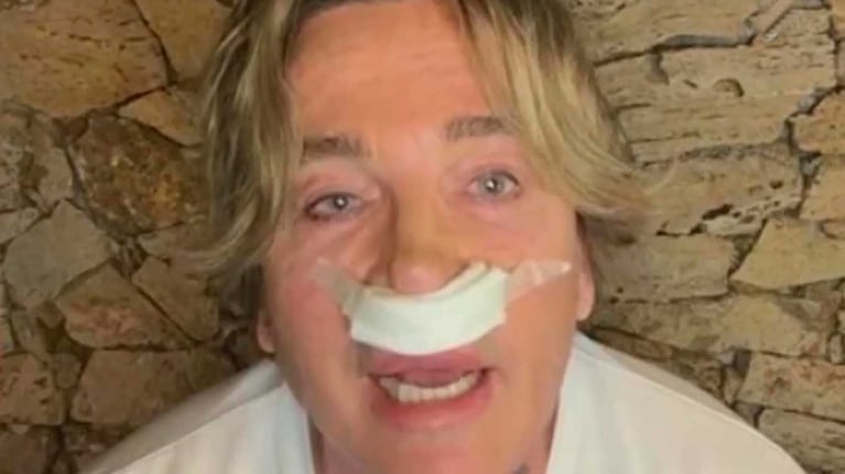 Guido Suller se sometió a una cirugía para parecerse a un famosísimo actor de Hollywood