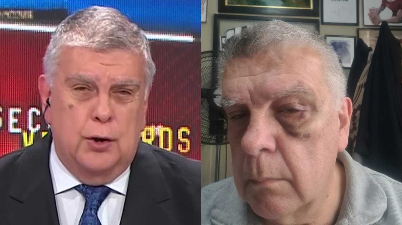 Luis Ventura, agredido en la cancha: el agresor pidió perdón y explicó su reacción