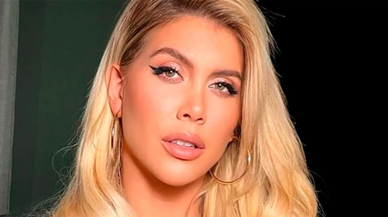 La palabra de Wanda Nara sobre su salud: "Estoy controlada"
