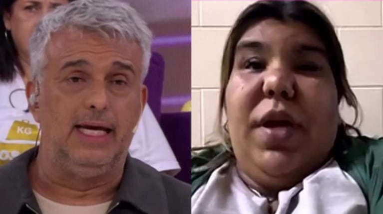 Preocupación por Camilota: está en silla de ruedas y no pudo ir a Cuestión de peso