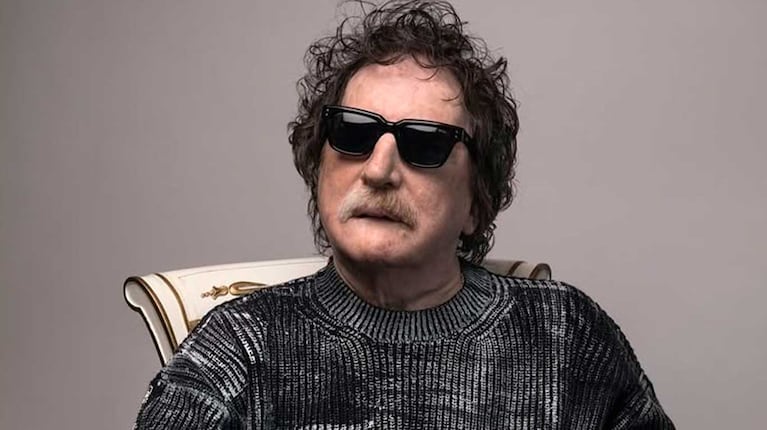 Operaron a Charly García para quitarle una parte del riñón: cuál es su estado de salud